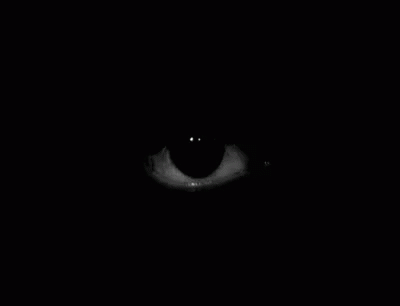 eyeball